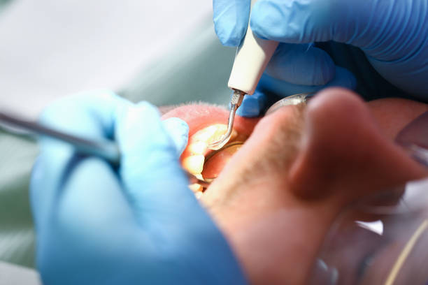 Best Emergency Dental Care for Abscessed Tooth in Raymond, MS