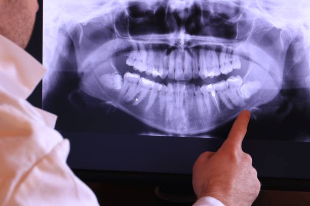Best Emergency Dental Extractions in Raymond, MS